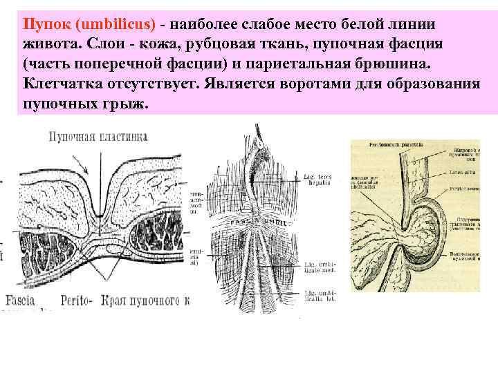 Пупок (umbilicus) - наиболее слабое место белой линии живота. Слои - кожа, рубцовая ткань,