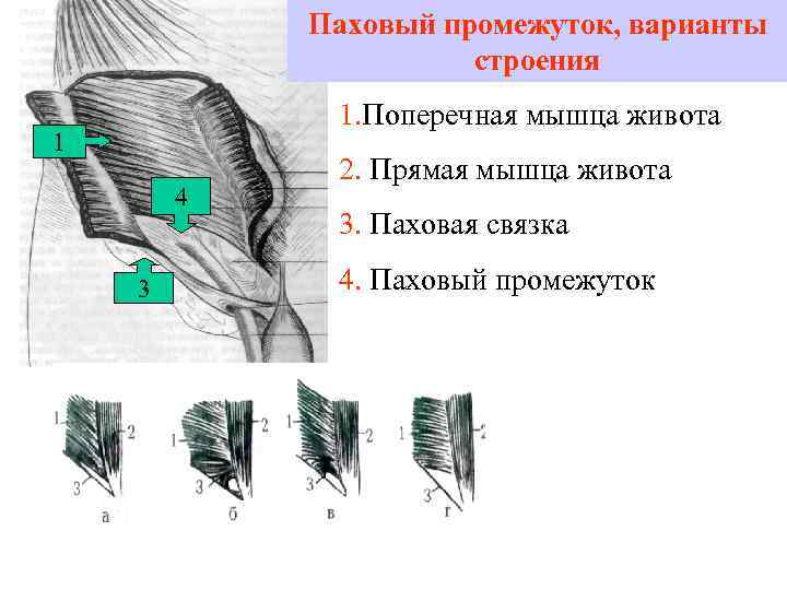   Паховый промежуток, варианты    строения   1. Поперечная мышца