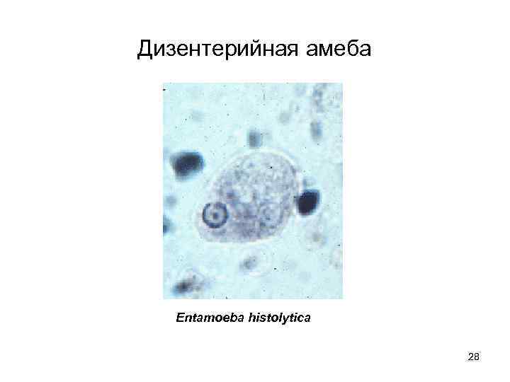 Дизентерийная амеба  Entamoeba histolytica     28 