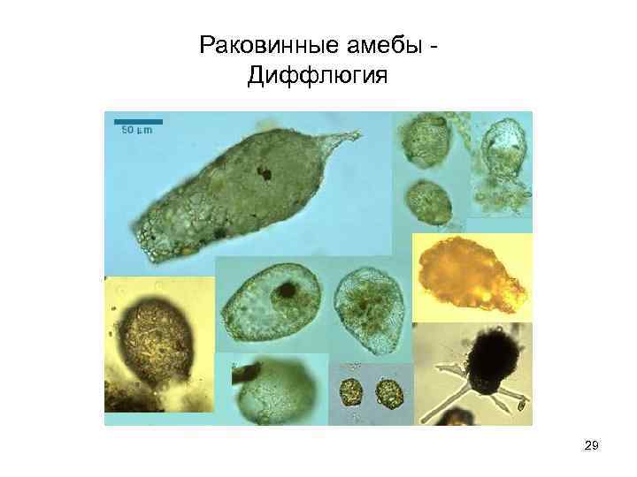 Раковинные амебы - Диффлюгия     29 