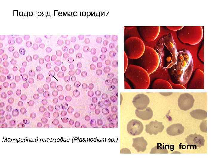   Подотряд Гемаспоридии Малярийный плазмодий (Plasmodium sp. )     