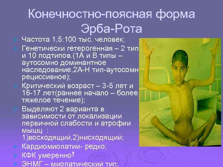  Конечностно-поясная форма   Эрба-Рота Ø  Частота 1, 5: 100 тыс. человек;