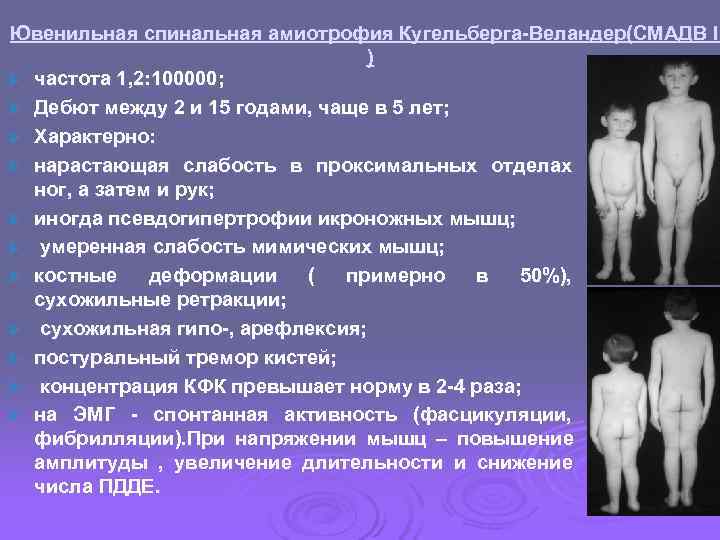 Ювенильная спинальная амиотрофия Кугельберга-Веландер(СМАДВ II       ) Ø частота