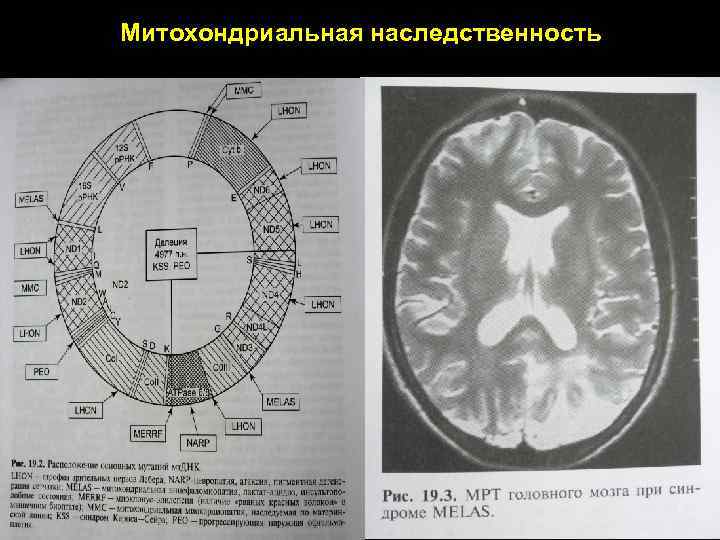 Митохондриальная наследственность 