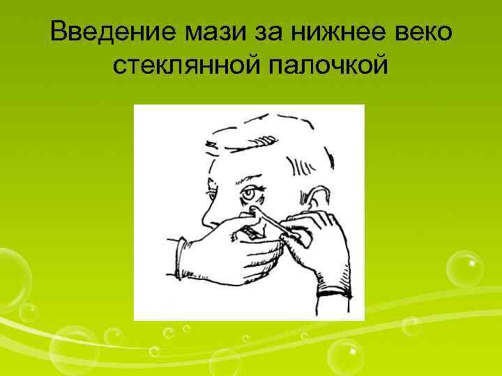 Введение мази за нижнее веко стеклянной палочкой 