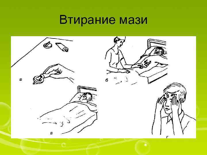 Втирание мази 