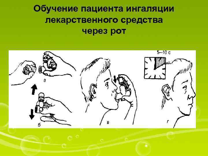 Обучение пациента ингаляции лекарственного средства через рот 