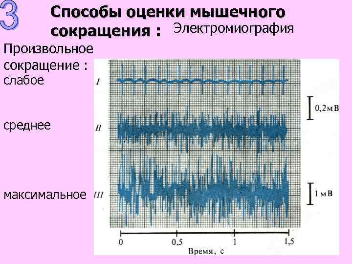 Способы оценки мышечного сокращения : Электромиография Произвольное сокращение : слабое среднее максимальное 
