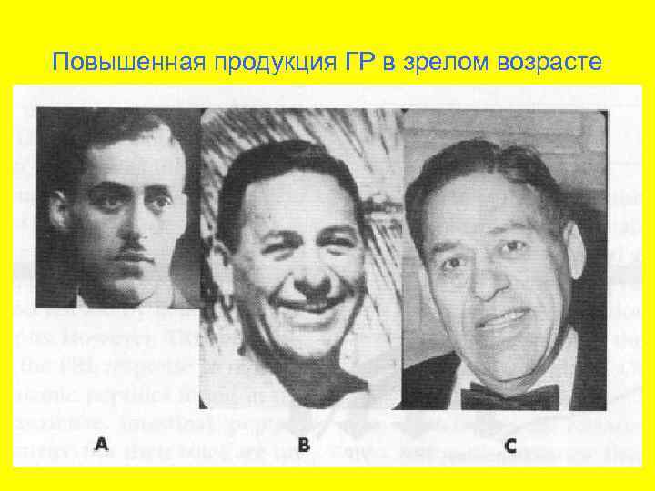 Повышенная продукция ГР в зрелом возрасте 
