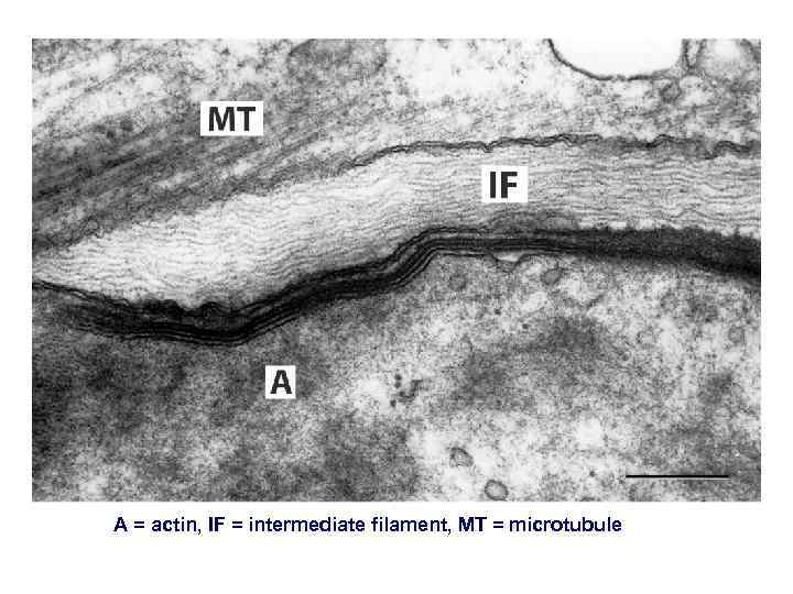 A = actin, IF = intermediate filament, MT = microtubule 