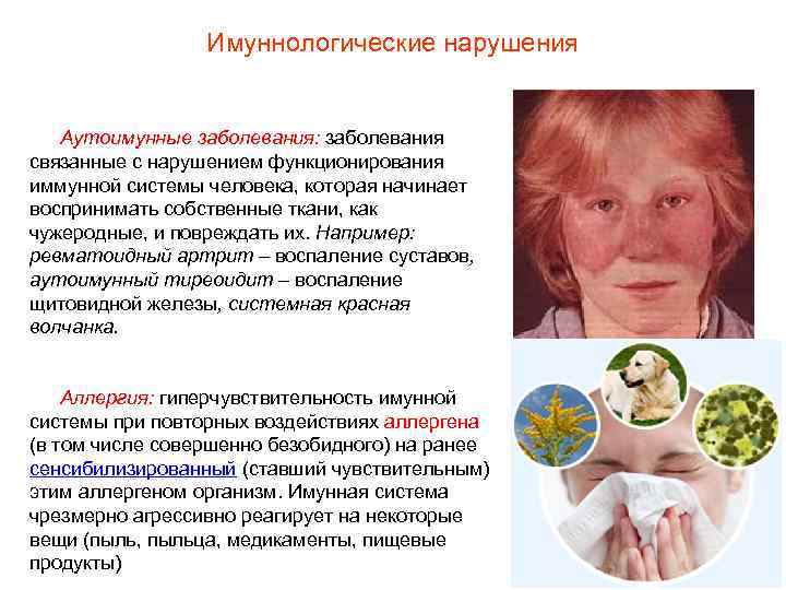    Имуннологические нарушения Аутоимунные заболевания: заболевания связанные с нарушением функционирования иммунной системы