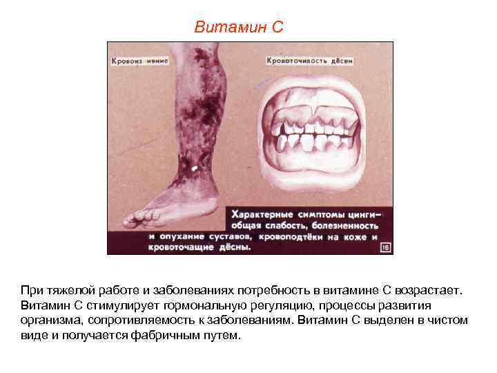       Витамин С При тяжелой работе и заболеваниях потребность