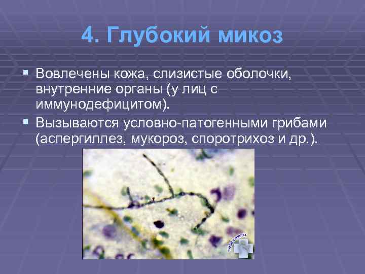 4. Глубокий микоз § Вовлечены кожа, слизистые оболочки, внутренние органы (у лиц с иммунодефицитом).