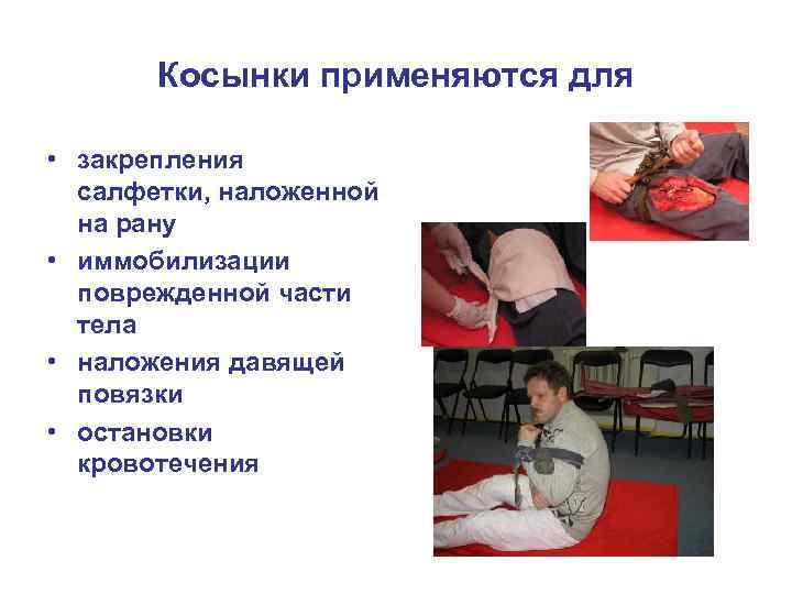 Косынки применяются для • закрепления салфетки, наложенной на рану • иммобилизации поврежденной части тела