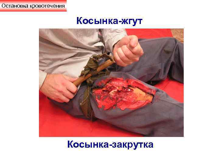 Остановка кровотечения Косынка-жгут Косынка-закрутка 