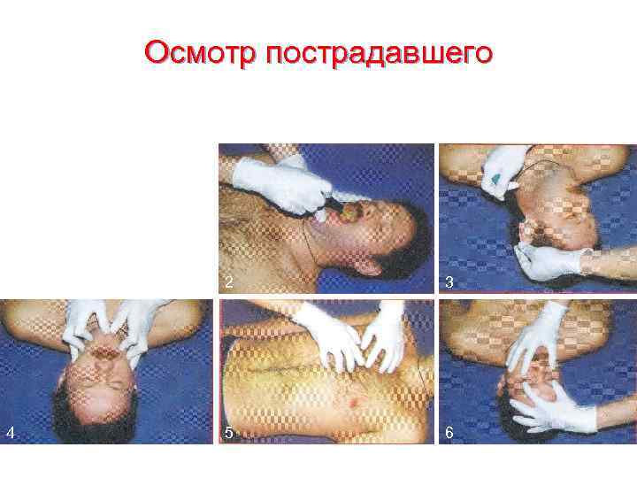   Осмотр пострадавшего 1  2  3 4  5  6