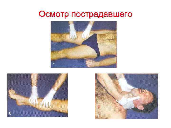   Осмотр пострадавшего  7 8   9 