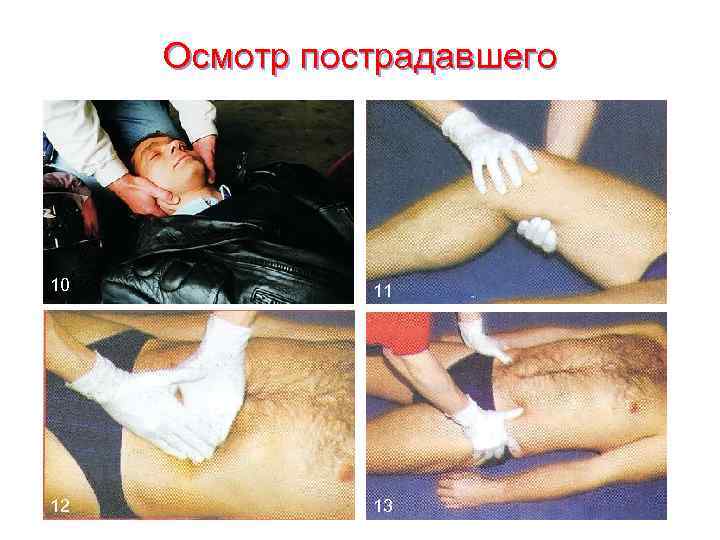  Осмотр пострадавшего 10   11 12   13 