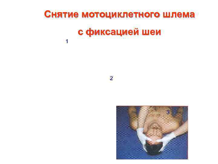 Снятие мотоциклетного шлема  с фиксацией шеи  1   2  