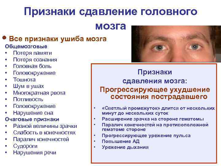  Признаки сдавление головного   мозга Все признаки ушиба мозга Общемозговые • Потеря