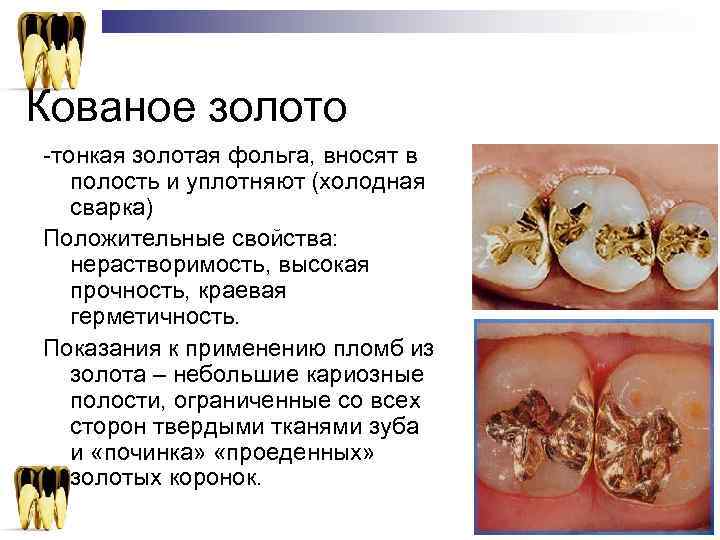 Кованое золото -тонкая золотая фольга, вносят в  полость и уплотняют (холодная  сварка)