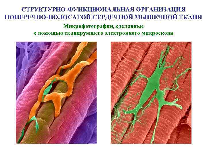 Строение поперечно полосатой мышечной ткани презентация