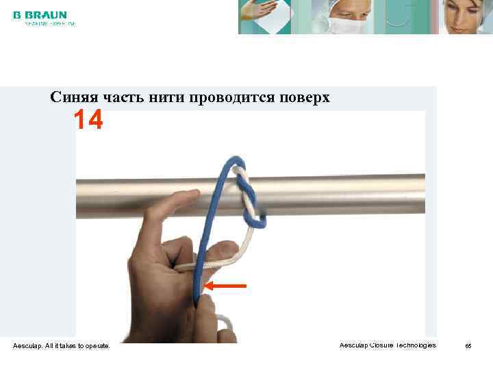   Синяя часть нити проводится поверх     14 Aesculap. All