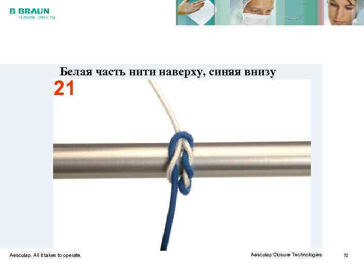     Белая часть нити наверху, синяя внизу    