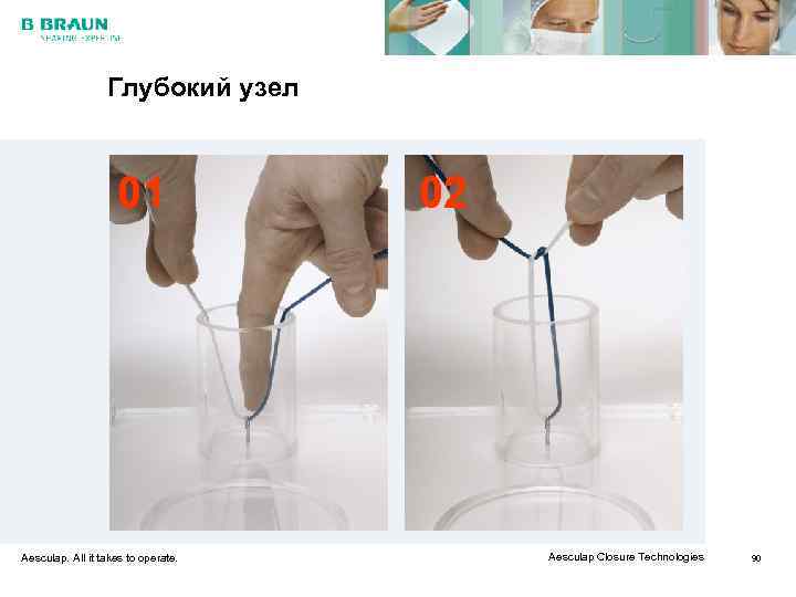    Глубокий узел    01    02 Aesculap.