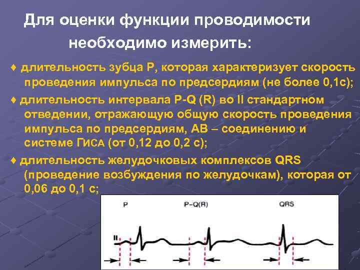  Для оценки функции проводимости  необходимо измерить: ♦ длительность зубца Р, которая характеризует