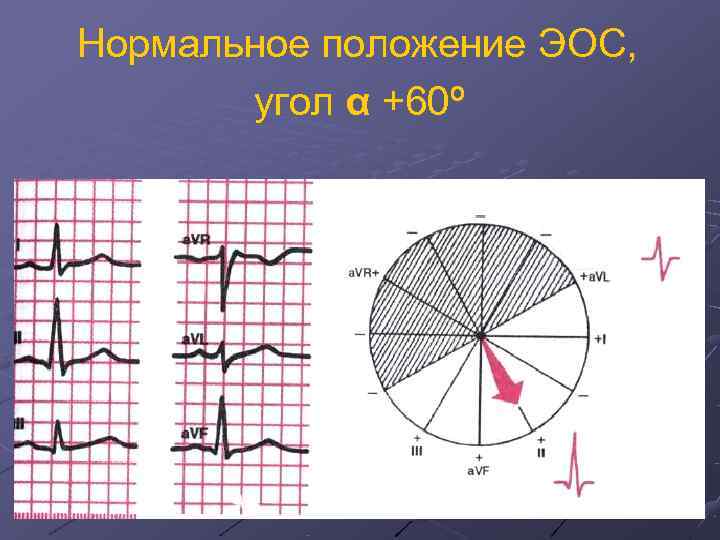 Нормальное положение ЭОС,   угол α +60º 