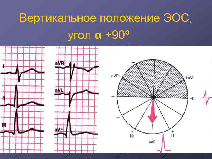 Вертикальное положение ЭОС,   угол α +90º 
