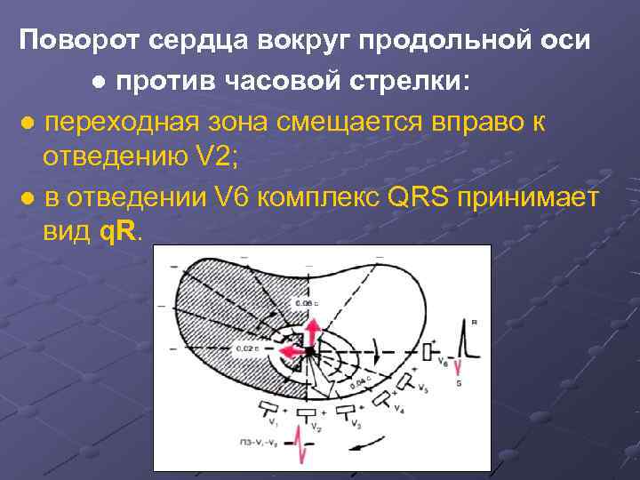 Поворот сердца. Повороты сердца вокруг оси на ЭКГ. Повороты сердца вокруг продольной оси на ЭКГ. Поворот сердца вокруг продольной оси против часовой стрелки. Поворот сердца вокруг продольной оси по часовой стрелке на ЭКГ.