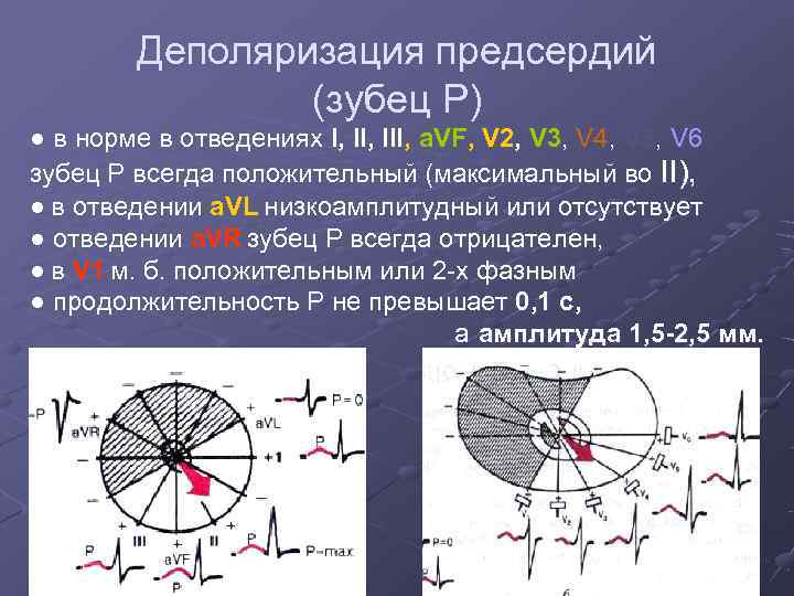   Деполяризация предсердий   (зубец Р) ● в норме в отведениях I,