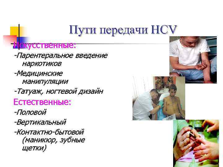    Пути передачи HCV Искусственные: -Парентеральное введение  наркотиков -Медицинские  манипуляции