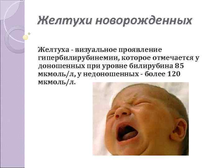 Желтухи новорожденных Желтуха - визуальное проявление гипербилирубинемии, которое отмечается у доношенных при уровне билирубина