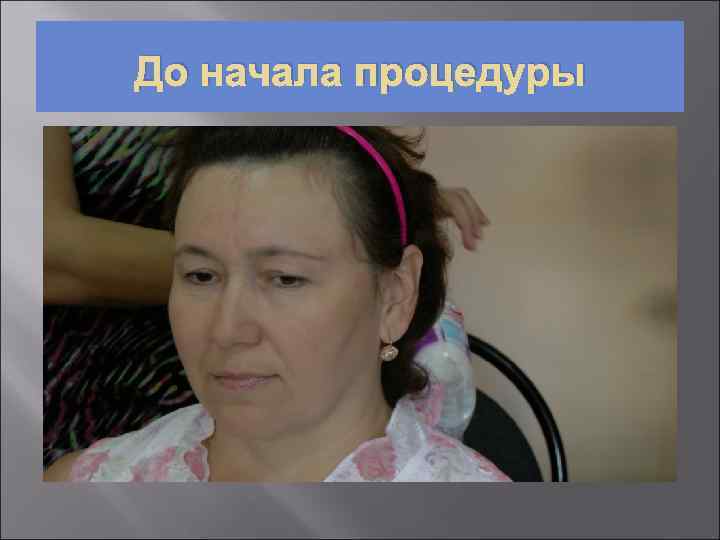 До начала процедуры 