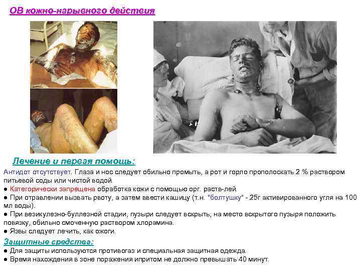  ОВ кожно-нарывного действия  Лечение и первая помощь: Антидот отсутствует. Глаза и нос