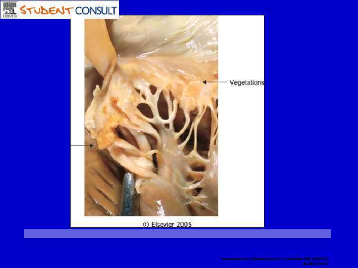 Downloaded from: Student. Consult (on 12 November 2008 10: 09 AM) © 2005 Elsevier