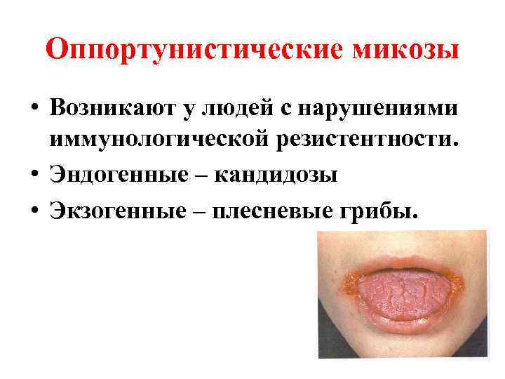  Оппортунистические микозы • Возникают у людей с нарушениями  иммунологической резистентности.  •