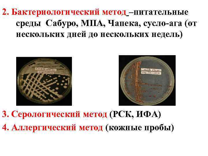 2. Бактериологический метод –питательные среды Сабуро, МПА, Чапека, сусло-ага (от нескольких дней до нескольких