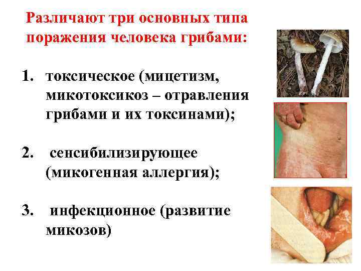 Различают три основных типа поражения человека грибами:  1. токсическое (мицетизм, микотоксикоз – отравления