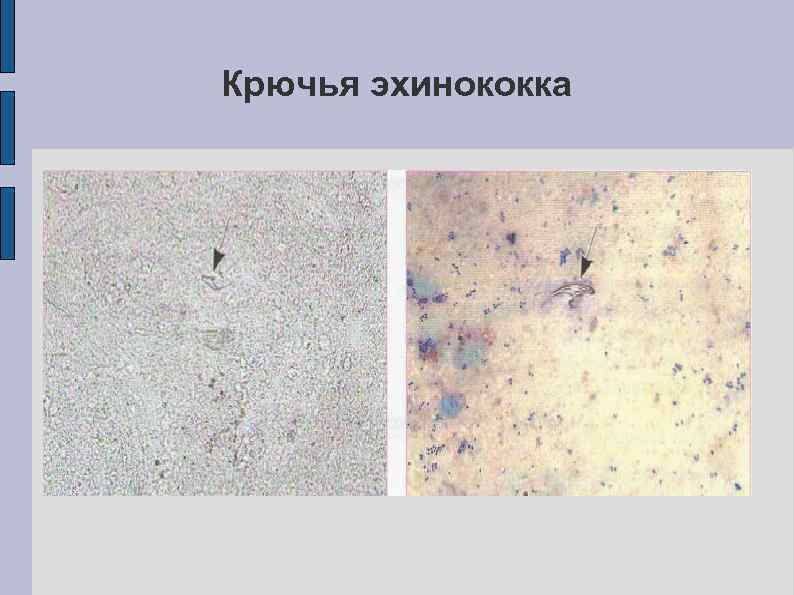 Крючья эхинококка 