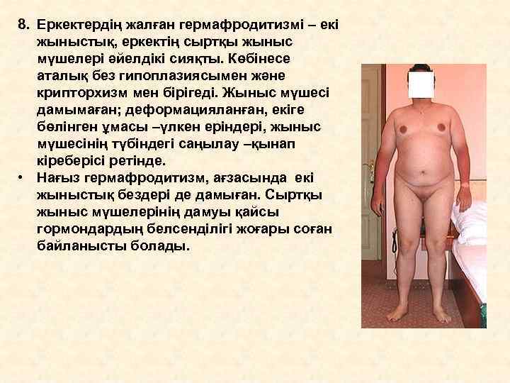 8. Еркектердің жалған гермафродитизмі – екі  жыныстық, еркектің сыртқы жыныс  мүшелері әйелдікі