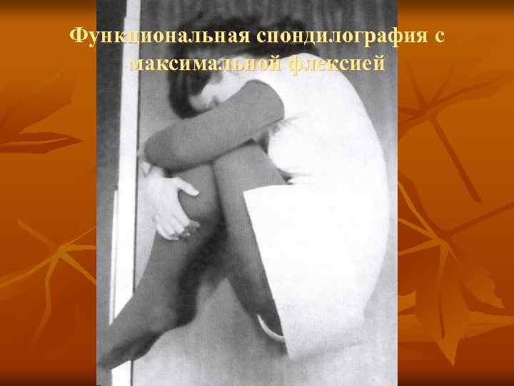 Функциональная спондилография с максимальной флексией 