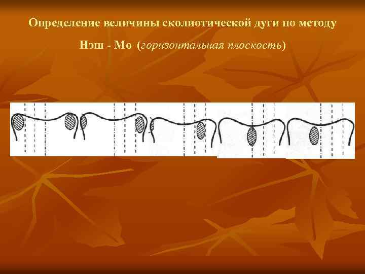 Определение величины сколиотической дуги по методу Нэш - Мо (горизонтальная плоскость) 