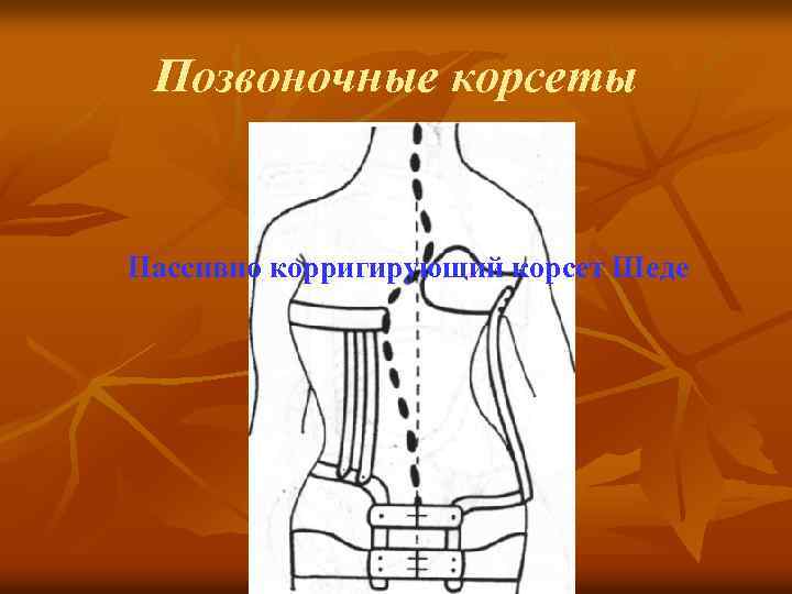 Позвоночные корсеты Пассивно корригирующий корсет Шеде 