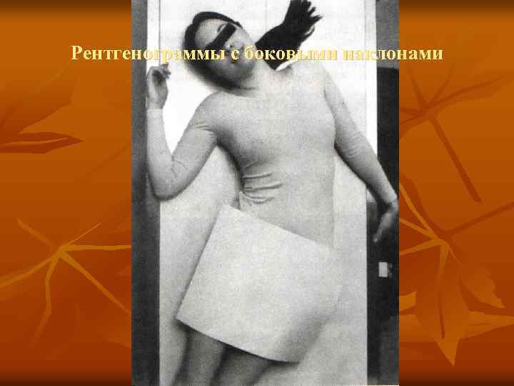 Рентгенограммы с боковыми наклонами 