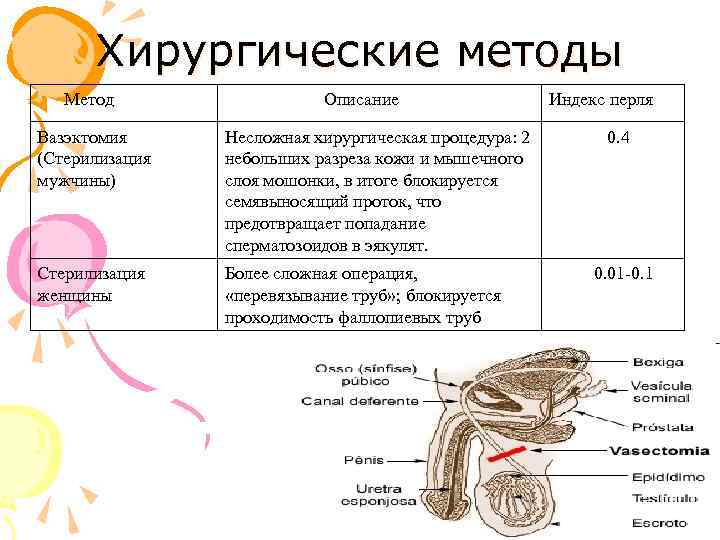 Хирургические методы Метод Описание Вазэктомия (Стерилизация мужчины) Несложная хирургическая процедура: 2 небольших разреза кожи