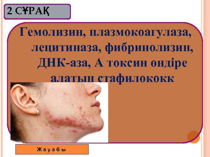 2 СҰРАҚ Гемолизин, плазмокоагулаза, лецитиназа, фибринолизин, ДНК-аза, А токсин өндіре алатын стафилококк Жауабы 